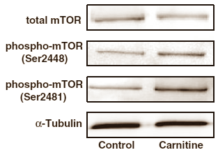 Suppletie met enkele grammen L-carnitine per dag remt misschien de moleculaire afbraakmachinerie die in je spiercellen bij zware inspanning, een tekort aan voedingsstoffen of inactiviteit spiereiwitten afbreekt. Dat suggereert een dierstudie die veterinaire wetenschappers van Justus-Liebig-University in het Duitse Giessen hebben gepubliceerd in Nutrition & Metabolism.