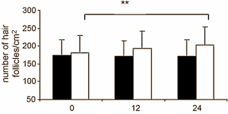 Carnitine is een haargroeimiddel