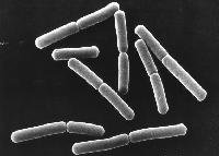 'Bacterie in Herbalife beschadigt lever'
