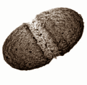 Staphylococcus epidermidis