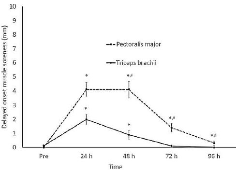 Bankdrukken net zo belastend voor de pecs als voor de triceps