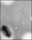 E.Coli 157