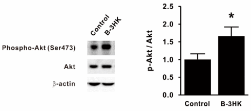 Bifidobacterium breve B3, een bacterie voor je spieren