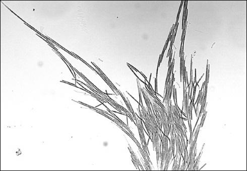 Aphanizomenon flos-aquae, de microalg die beschadigde spieren repareert