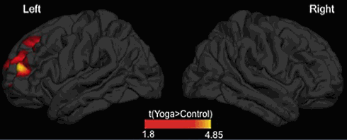 Scans liegen niet - Yoga beschermt tegen dementie